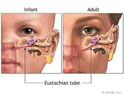 can you use a leaf blower with eusphatian tube dysfunction